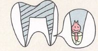 一般歯科画像