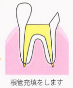 一般歯科画像